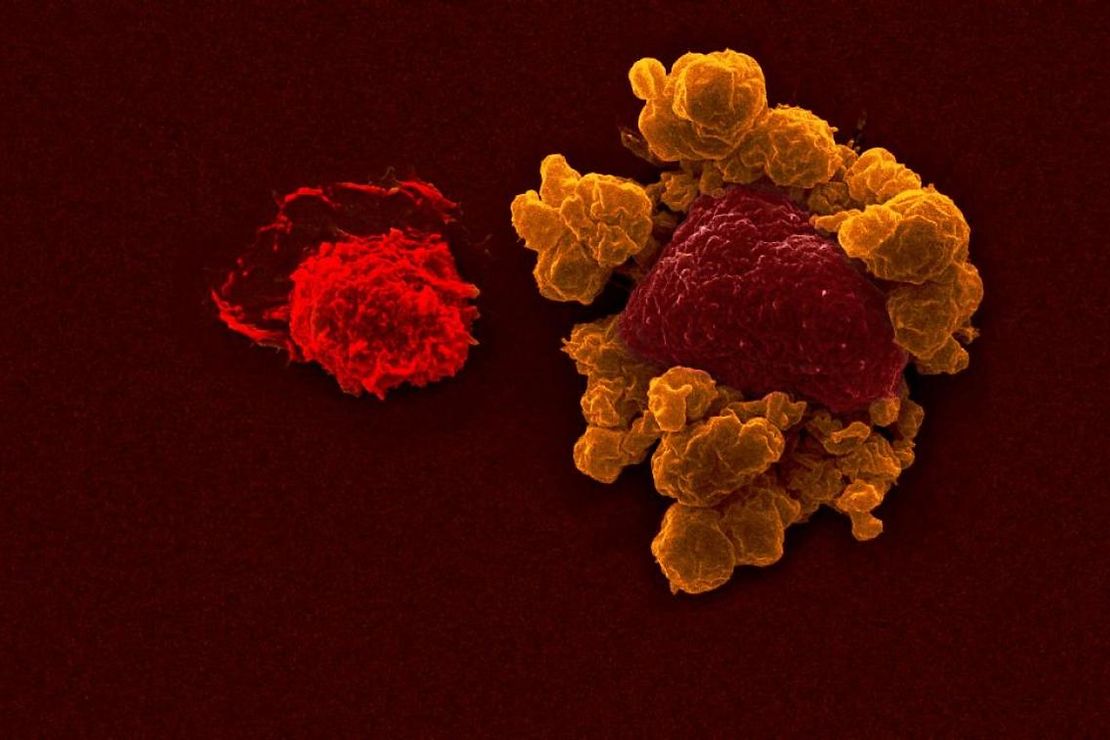 Electron microscope image of tumour cell